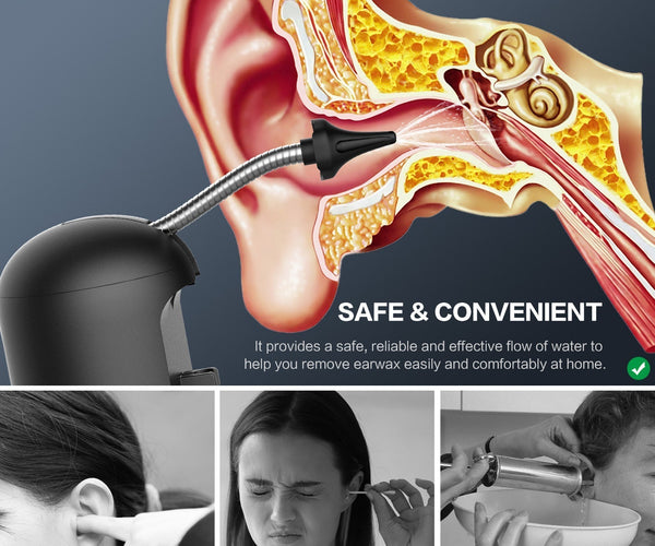 Why the NHS Stopped Ear Irrigation & What to Do Instead – Charles Medical
