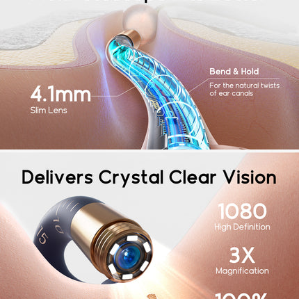 Bebird Ear HD Camera & Tweezers – Smart Otoscope with Replaceable Tips for Adults & Kids