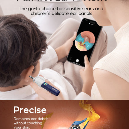 Bebird Ear HD Camera & Tweezers – Smart Otoscope with Replaceable Tips for Adults & Kids