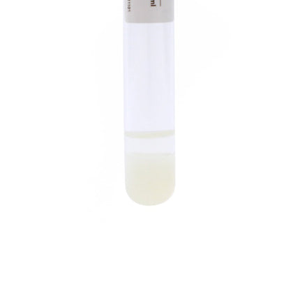 Manson Classic PRP Tubes 10ml (4pcs) – ACD Gel Separator Tubes for Platelet-Rich Plasma Therapy